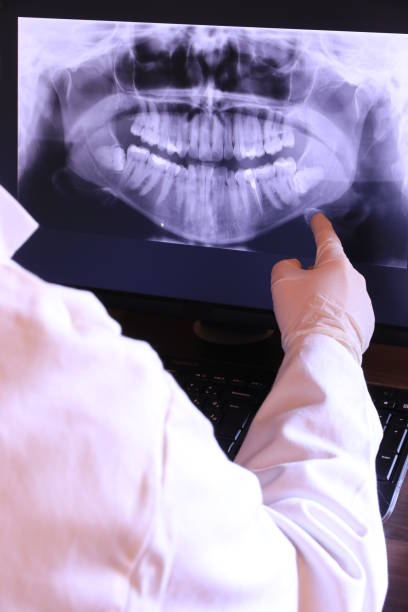 Best Emergency Dentist for Knocked-Out Tooth in South Patrick Shores, FL