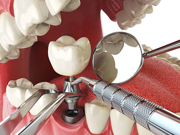 Best Emergency Cosmetic Dentistry in South Patrick Shores, FL