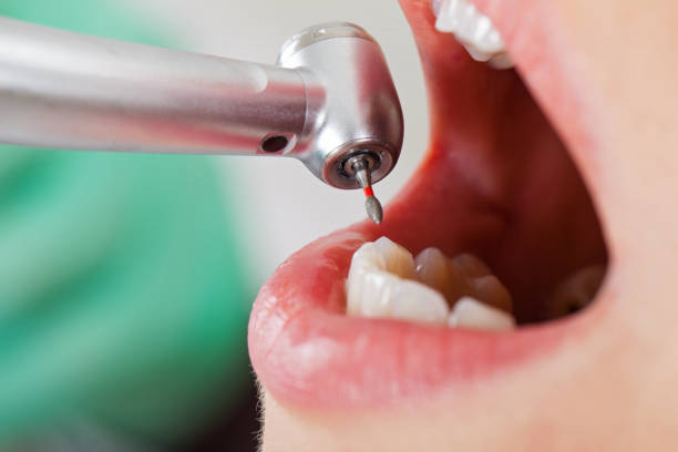 Best Pediatric Emergency Dentist in South Patrick Shores, FL